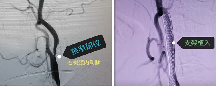 1612162682956978.png 微信圖片_20210201145752.png